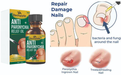 Anti Paronychia Relief Oil (20 ml) – Fast-Acting Nail & Cuticle Care | Pack of 2