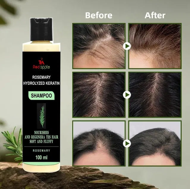 🌿 Rosemary Hydrolyzed Keratin Shampoo – Revive, Repair & Rejuvenate Your Hair Naturally! (100ml) (PACK oF 2)