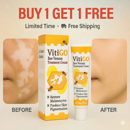 Bee Venom Vitigo Correcting Cream - (Pack of 2)